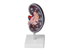 Модель почки в разрезе - fgospostavki.ru - Апрелевка