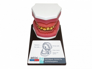 Демонстрационная модель "Ротовая полость курильщика" - fgospostavki.ru - Апрелевка
