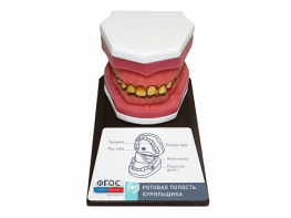Демонстрационная модель "Ротовая полость курильщика" - fgospostavki.ru - Апрелевка
